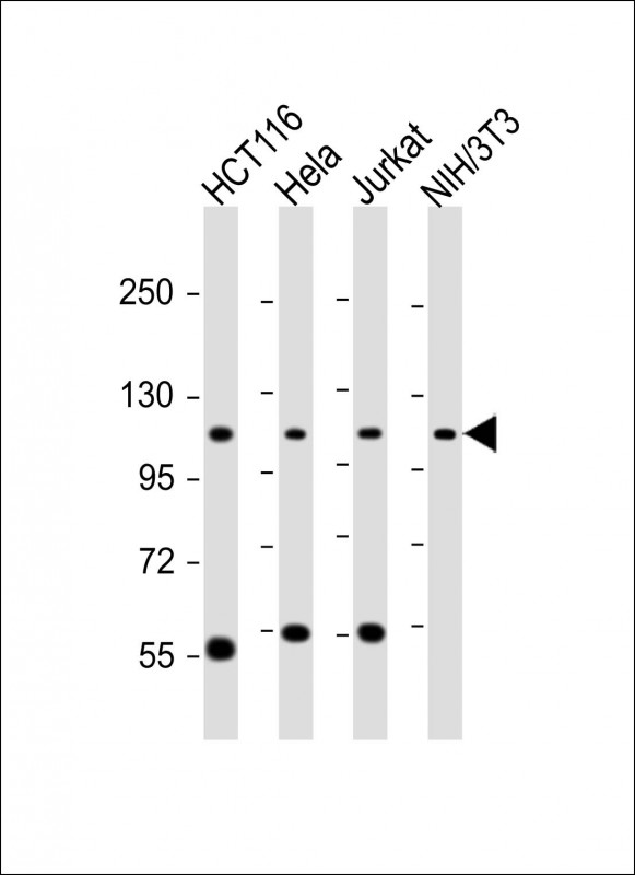 Rabbit Polyclonal Antibody to PRPF6 (N-term)