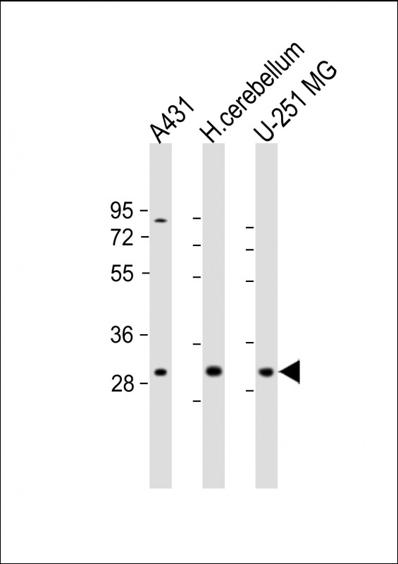 Rabbit Polyclonal Antibody to BCDIN3D