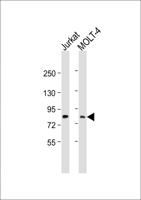 Rabbit Polyclonal Antibody to LCP2