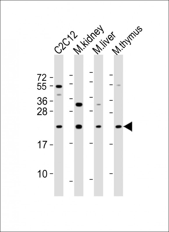Rabbit Polyclonal Antibody to Mouse DHFR
