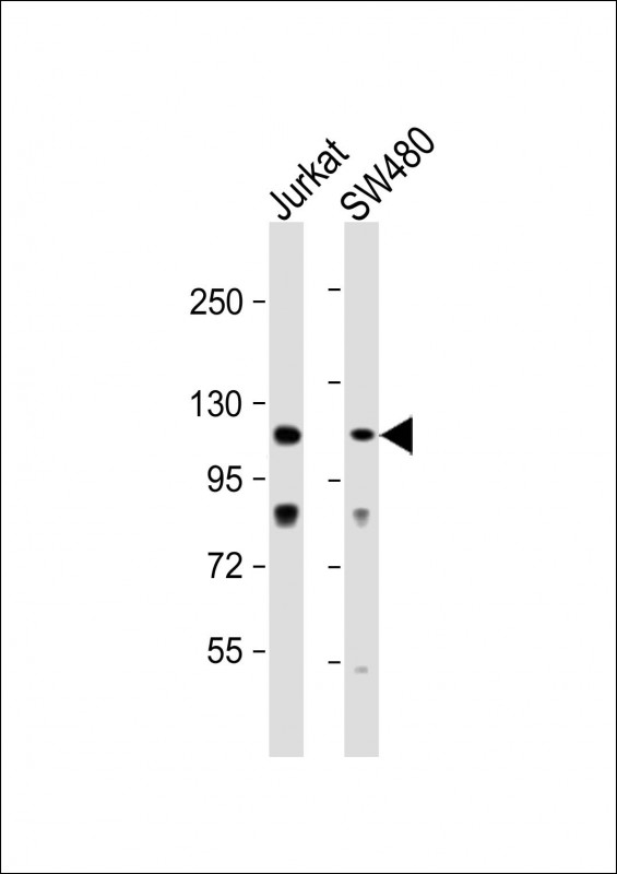 Rabbit Polyclonal Antibody to MLK1