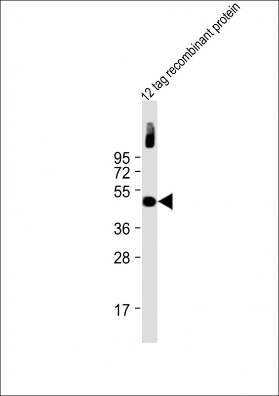 Mouse Monoclonal Antibody to Myc Tag