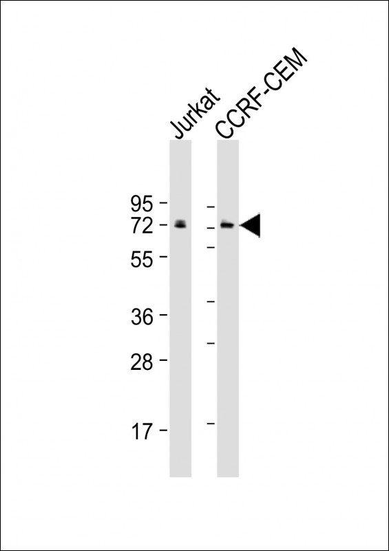Mouse Monoclonal Antibody to CBFA2T3