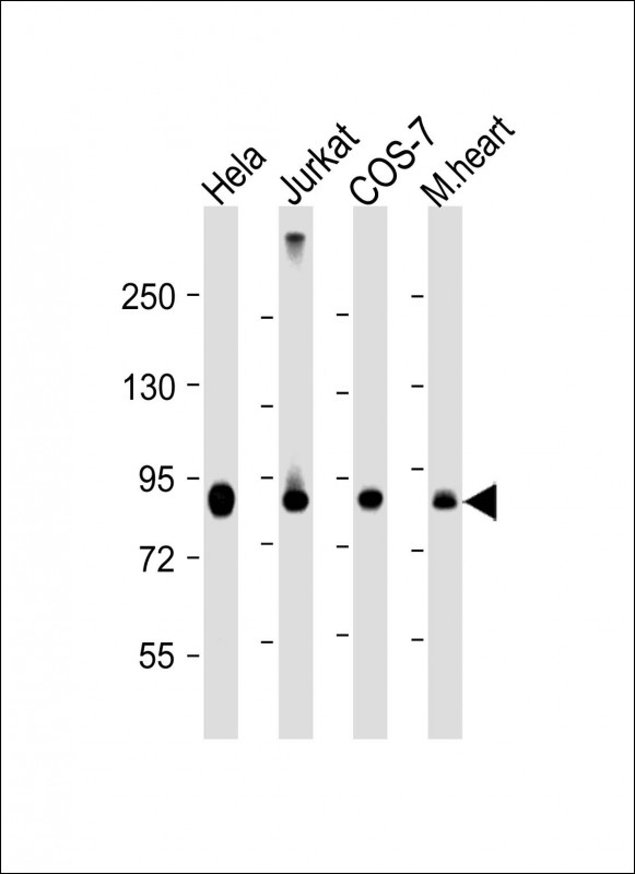 Mouse Monoclonal Antibody to PFKP
