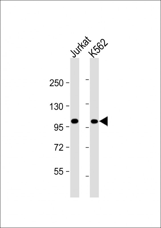 Mouse Monoclonal Antibody to PRDM16