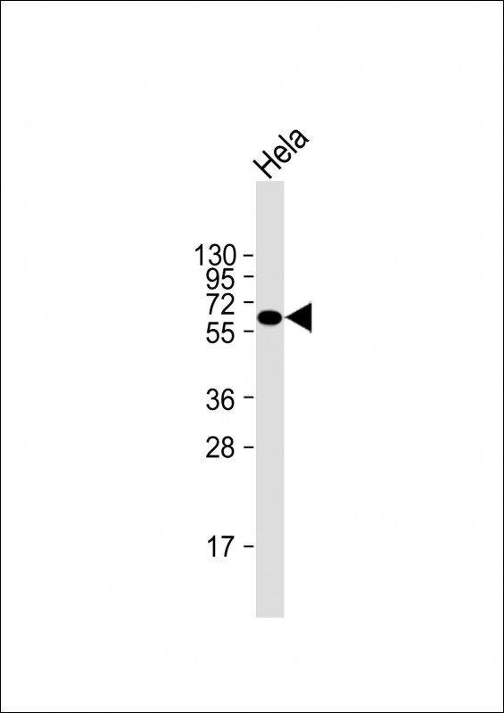 Mouse Monoclonal Antibody to Natriuretic Peptide Receptor C