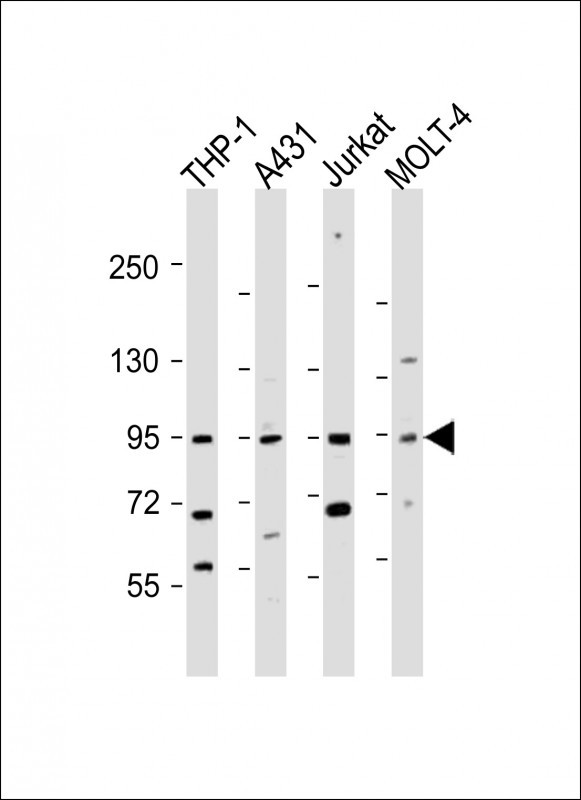 Rabbit Polyclonal Antibody to IL12_2