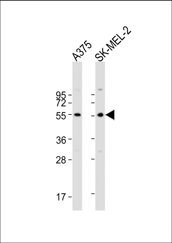 Rabbit Polyclonal Antibody to GSDMC