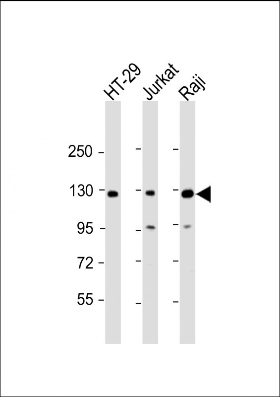 Rabbit Polyclonal Antibody to RBL2 (N-term)