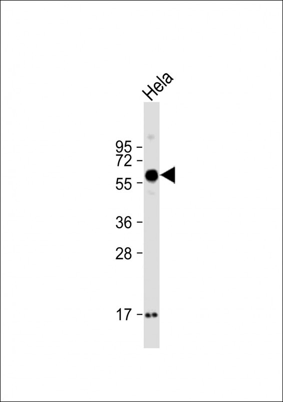 Rabbit Polyclonal Antibody to SMOC1