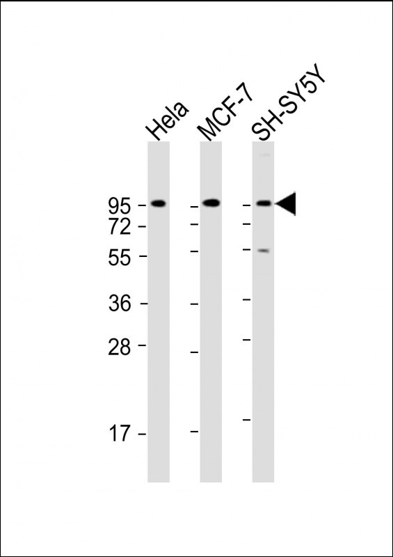 Rabbit Polyclonal Antibody to DAG1