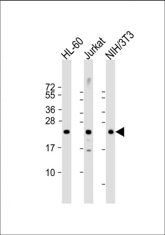 Rabbit Polyclonal Antibody to RHOC