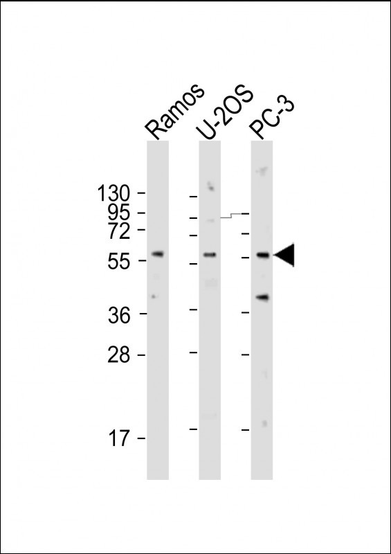 Rabbit Polyclonal Antibody to TRIM6  (N-term)