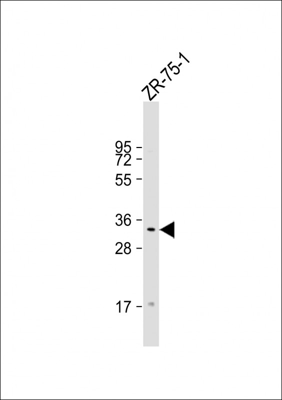 Rabbit Polyclonal Antibody to TAS2R50