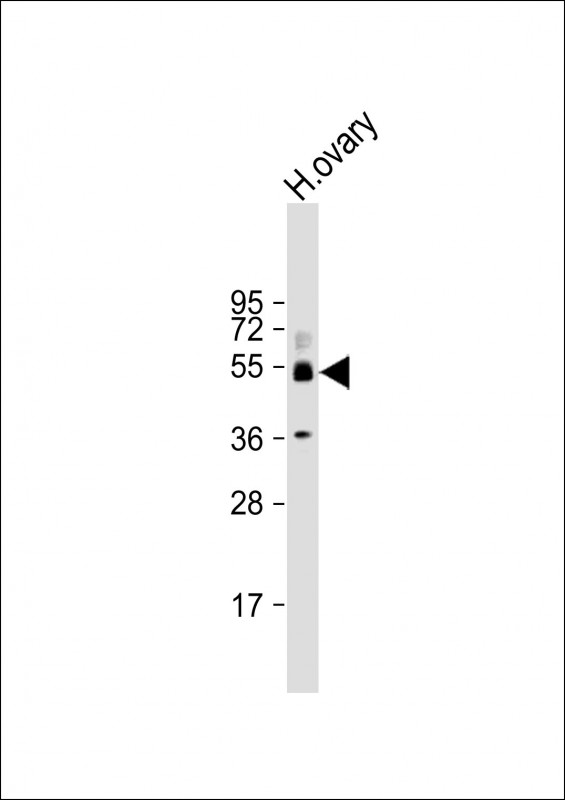 Rabbit Polyclonal Antibody to SH3BP5 (N-Term)