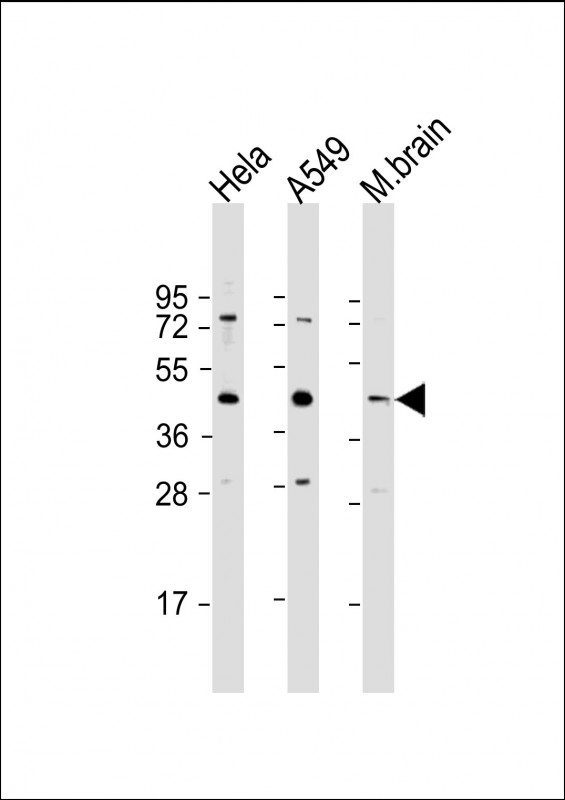 Rabbit Polyclonal Antibody to G6PC3