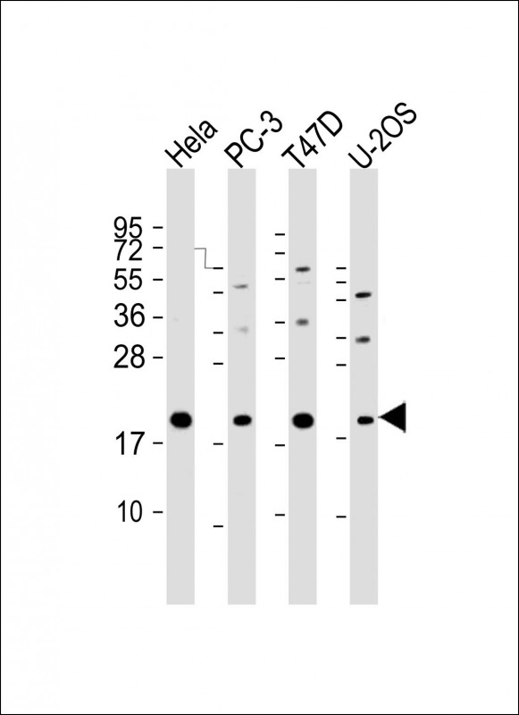 Rabbit Polyclonal Antibody to ANAPC11