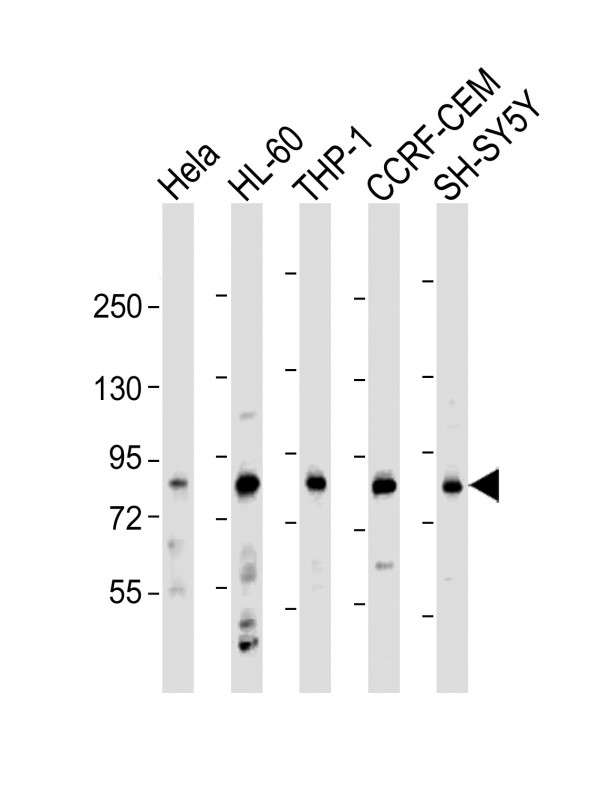 Rabbit Polyclonal Antibody to LRCH4