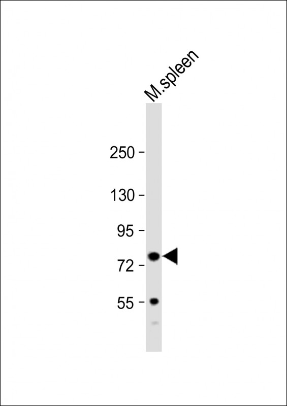 Rabbit Polyclonal Antibody to FERMT3 (N-Term)