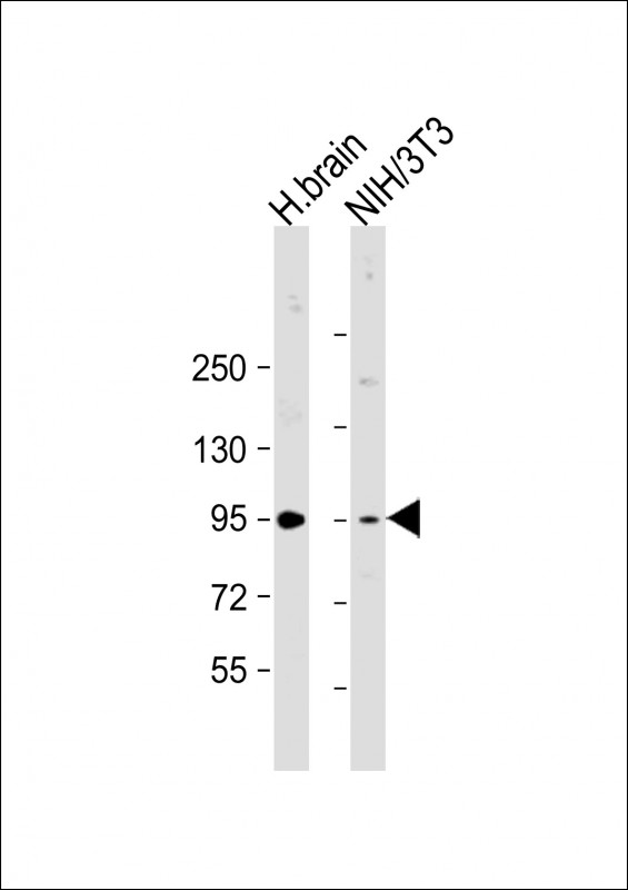 Rabbit Polyclonal Antibody to PRKD2