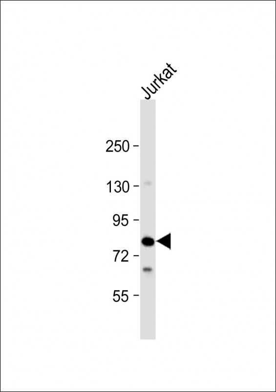 Rabbit Polyclonal Antibody to LCP2 (N-Term)
