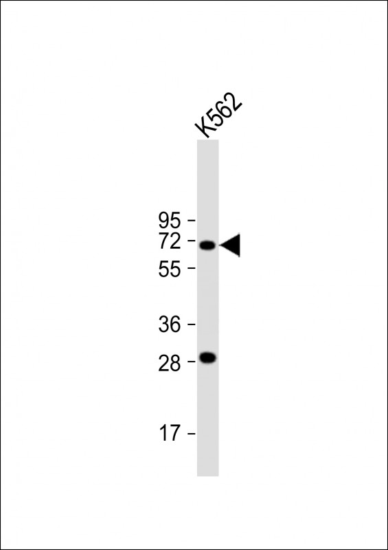 Rabbit Polyclonal Antibody to STT3A