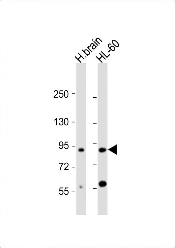 Rabbit Polyclonal Antibody to CCDC144A