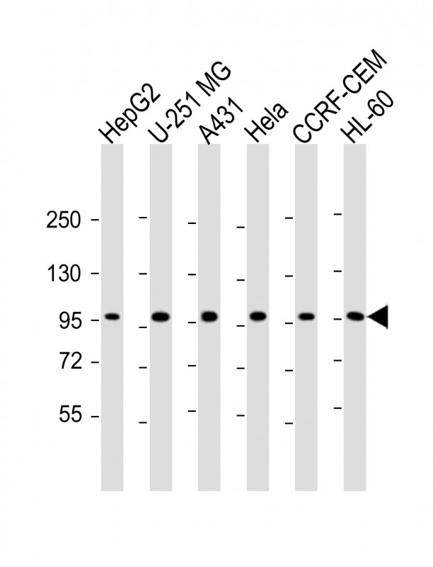 Rabbit Polyclonal Antibody to TAF4