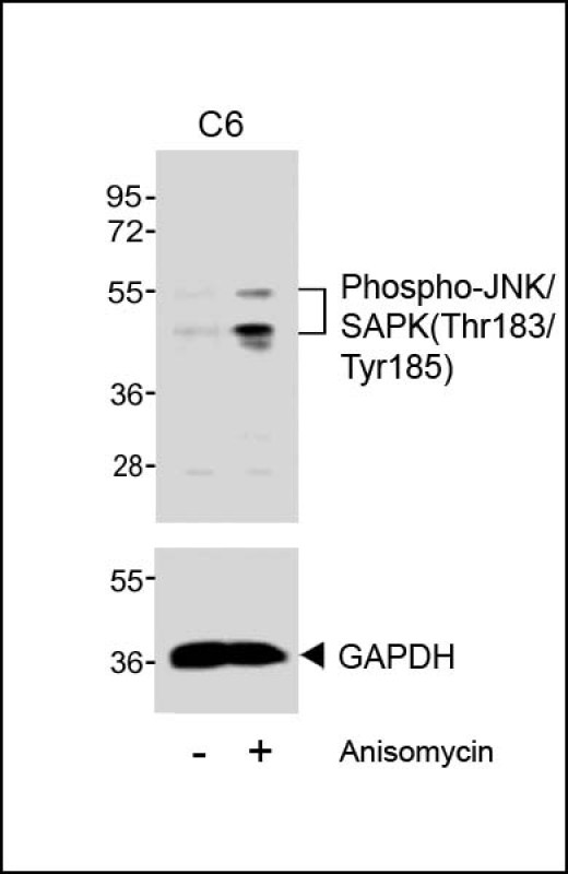 Rabbit Polyclonal Antibody to Phospho-JNK/SAPK(Thr183/Tyr185)