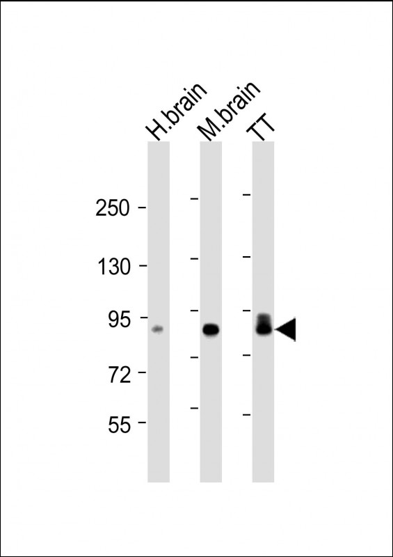 Mouse Monoclonal Antibody to DCLK1