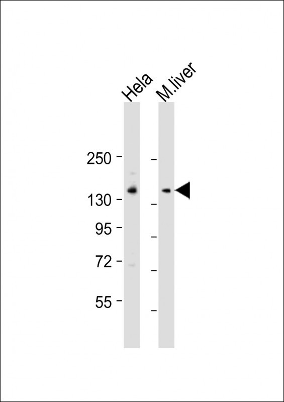 Rabbit Polyclonal Antibody to LMTK3 (N-term)