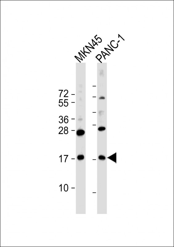 Rabbit Polyclonal Antibody to FAM159B