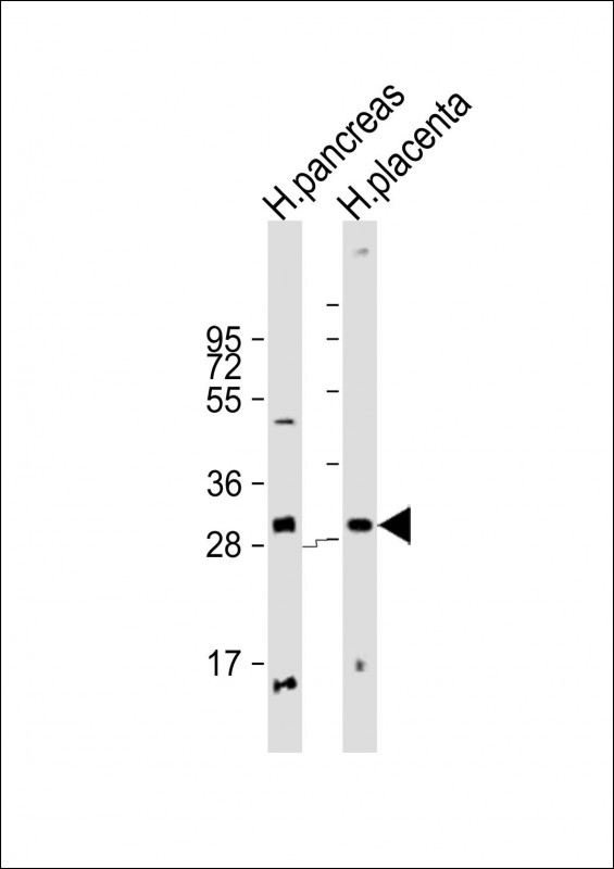 Rabbit Polyclonal Antibody to PPP1R3E