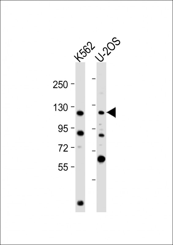 Rabbit Polyclonal Antibody to NOP2 (N-Term)