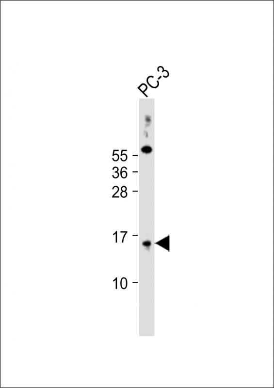 Rabbit Polyclonal Antibody to SYNJ2BP (N-Term)