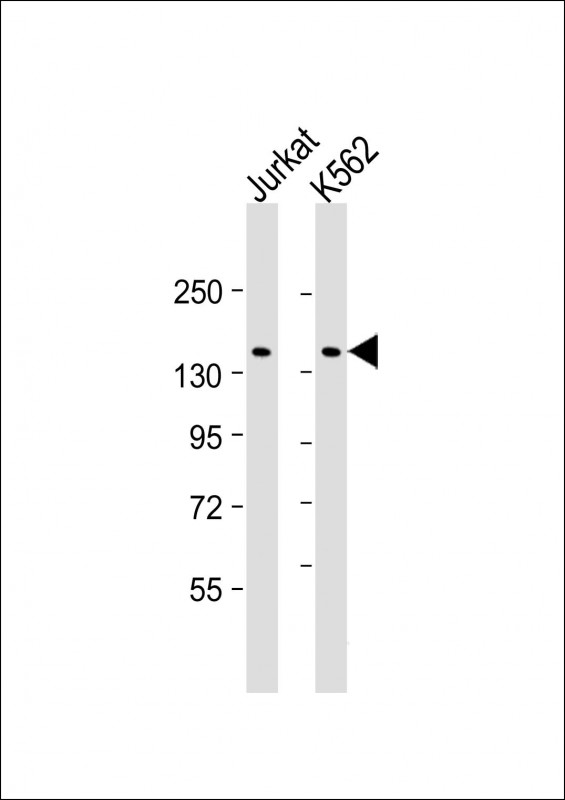 Mouse Monoclonal Antibody to KANK1