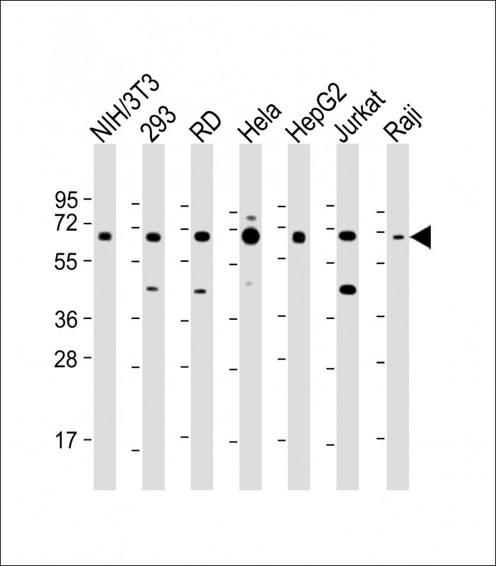 Rabbit Polyclonal Antibody to IGF2BP1