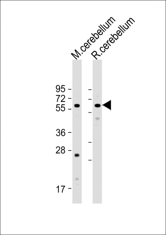 Rabbit Polyclonal Antibody to SLC11A2