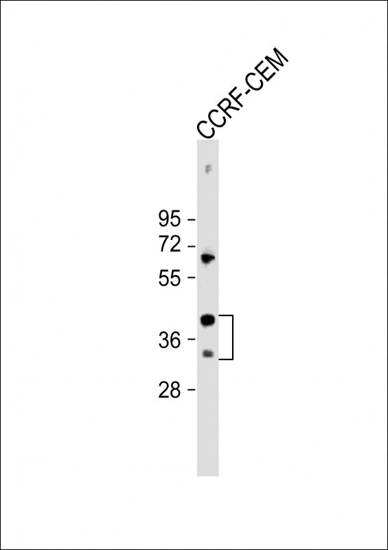 Rabbit Polyclonal Antibody to Mouse Nkx2-5