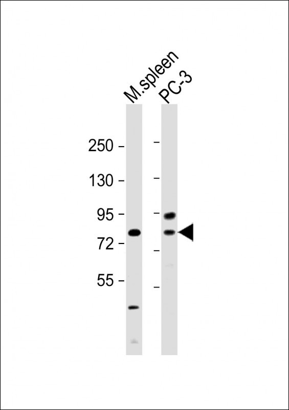 Rabbit Polyclonal Antibody to SYVN1 (HRD1)