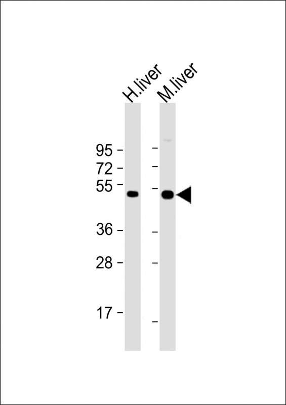Rabbit Polyclonal Antibody to CTBS