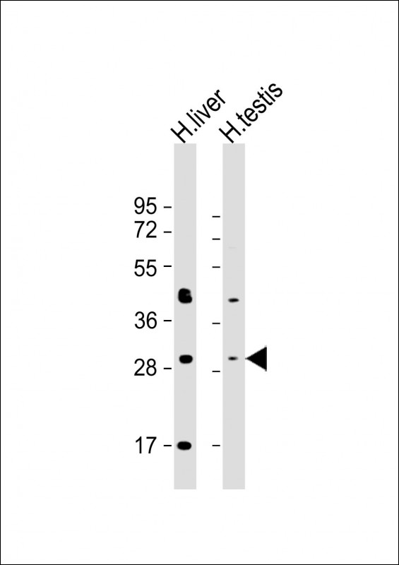 Rabbit Polyclonal Antibody to SRD5A1