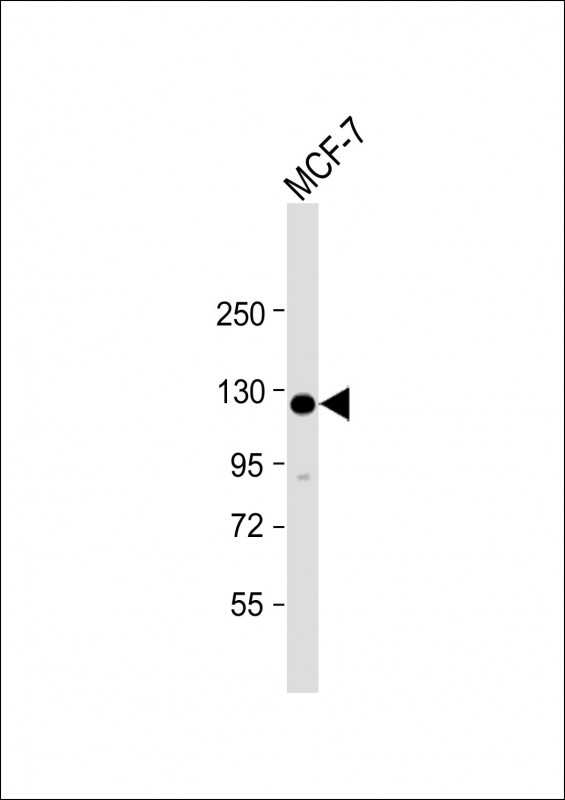 Rabbit Polyclonal Antibody to HEATR6 (N-Term)