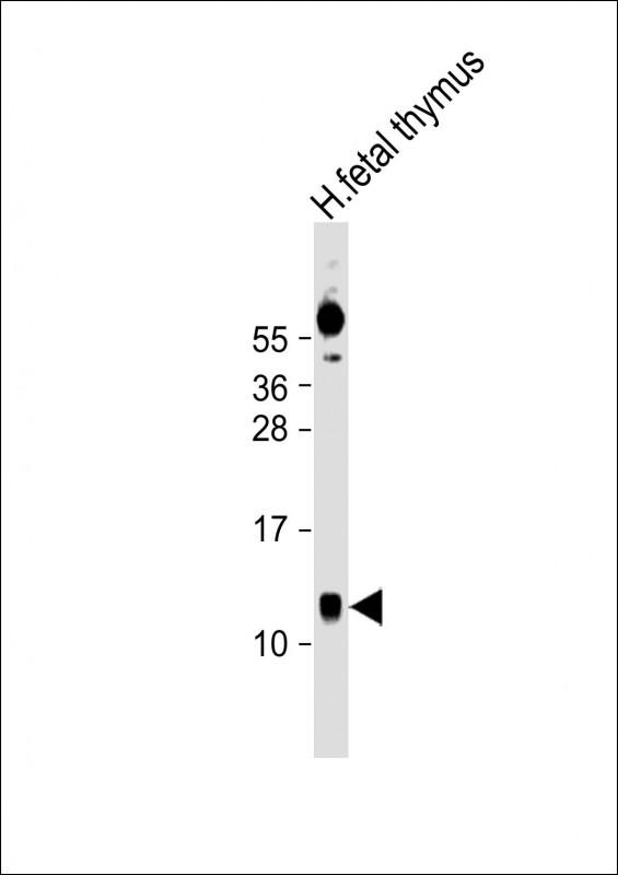 Rabbit Polyclonal Antibody to AHSP
