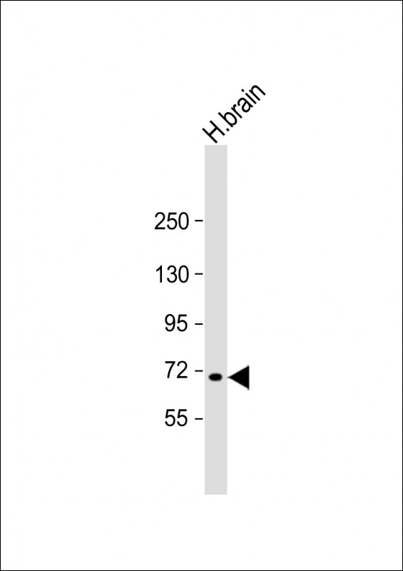 Rabbit Polyclonal Antibody to MAN1C1 (N-Term)