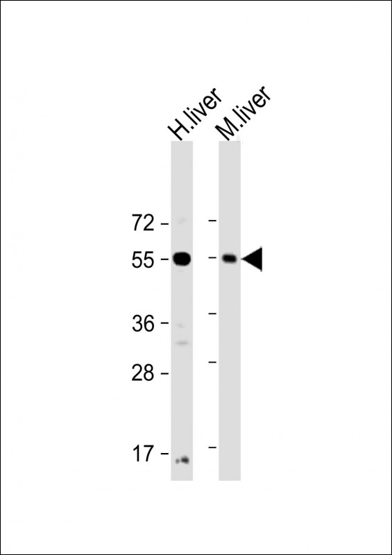 Rabbit Polyclonal Antibody to UGT1A9 (N-Term)