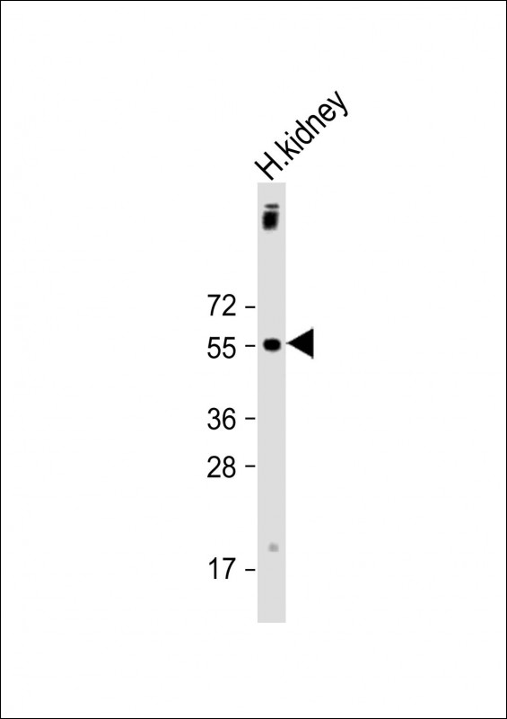 Rabbit Polyclonal Antibody to UGT1A9