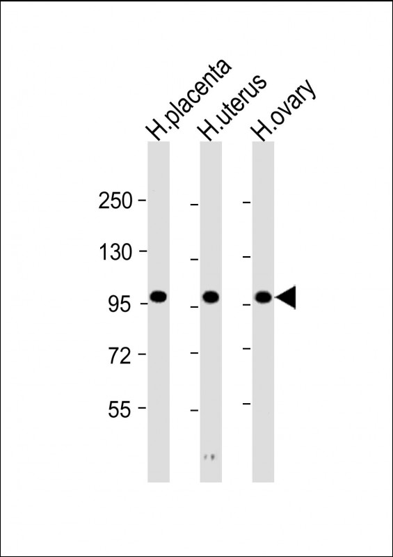 Rabbit Polyclonal Antibody to OVGP1 (N-Term)