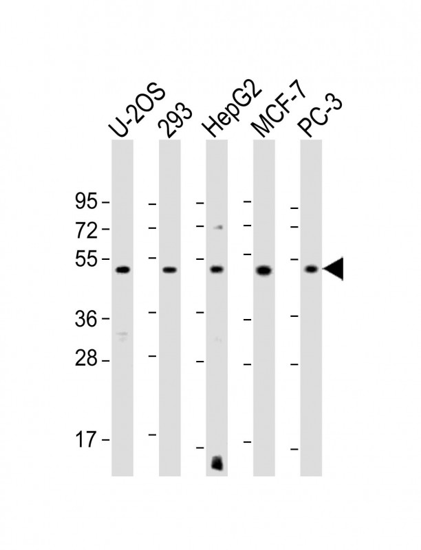 Rabbit Polyclonal Antibody to EEF1A1P5