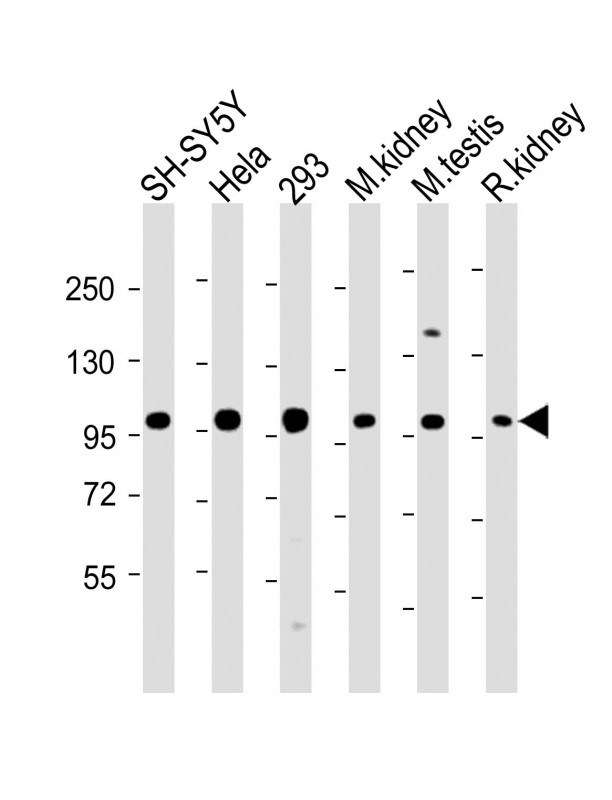 Rabbit Polyclonal Antibody to PGAP1 (N-Term)